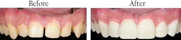 dental images 94110